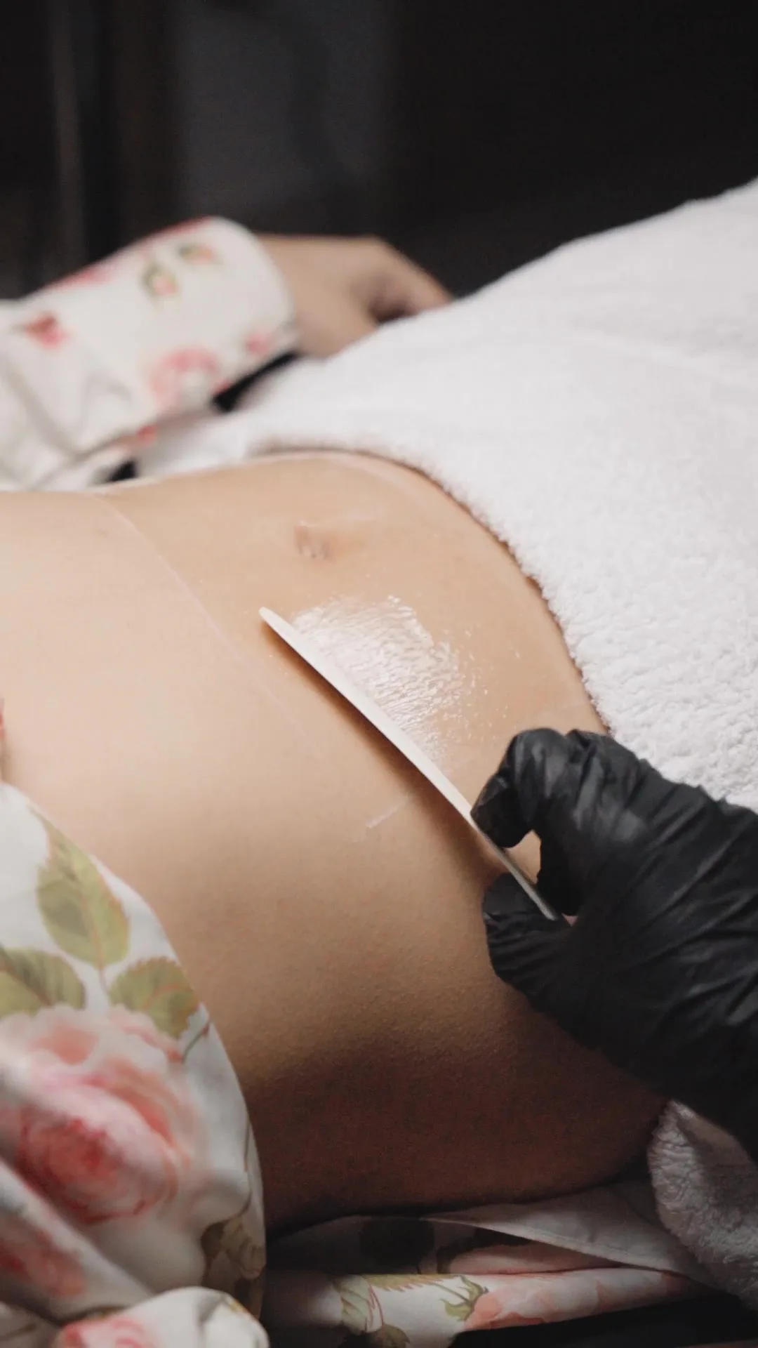 Body treatment session on the abdomen at Venus Aesthetics