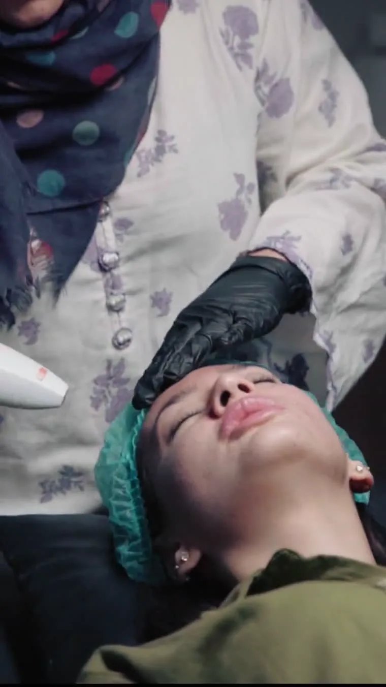 Acne scar resurfacing treatment at Venus Aesthetics