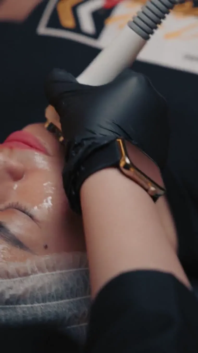 Upper arm treatment session at Venus Aesthetics