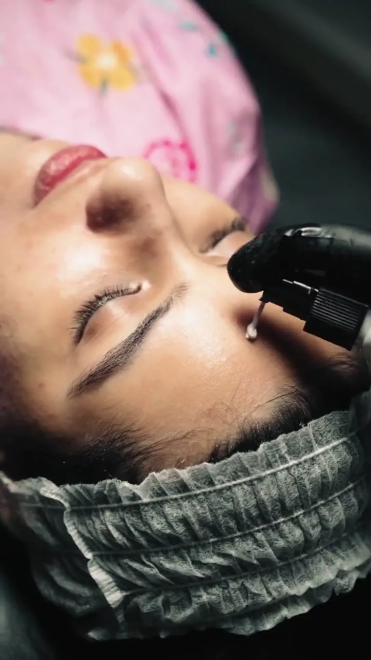 Party Peel glow facial at Venus Aesthetics