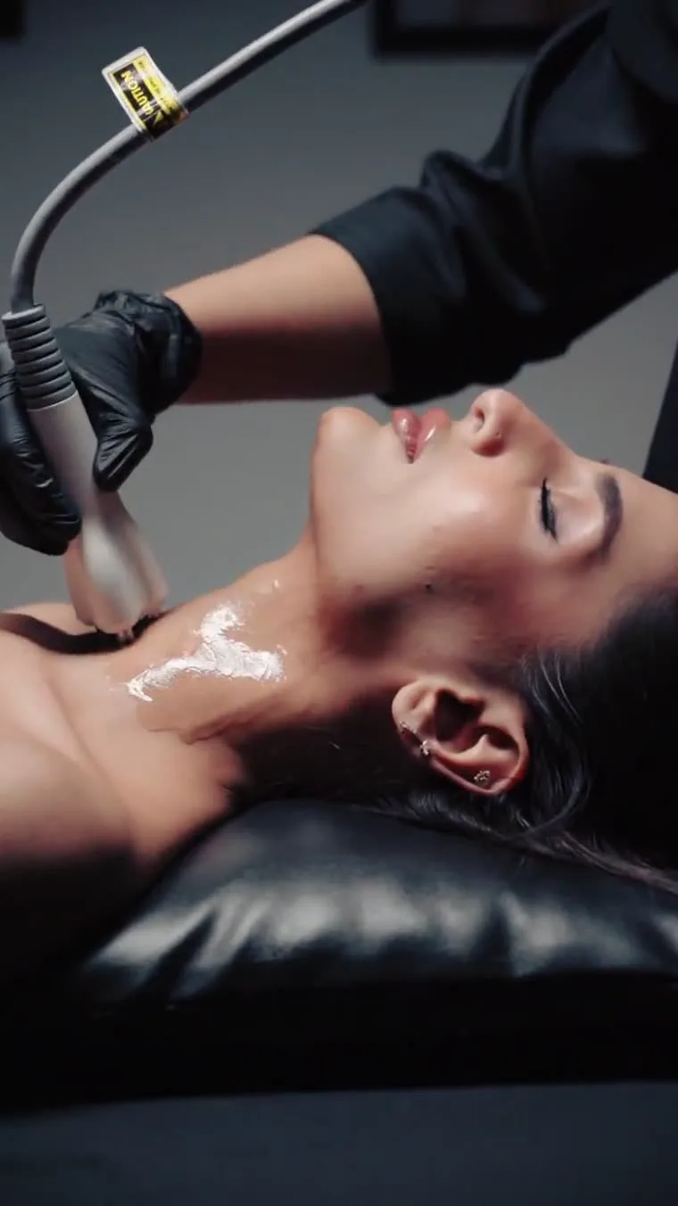 Venus Legacy neck tightening session at Venus Aesthetics