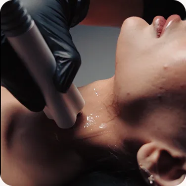 HydraFacial treatment glow at Venus Aesthetics