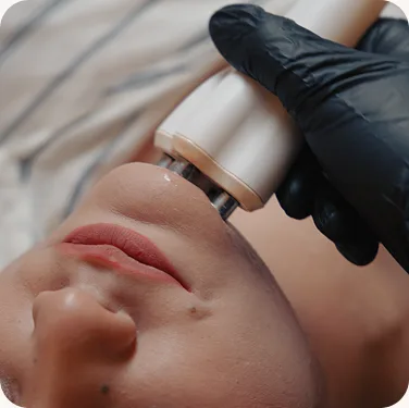 Exosome facial treatment at Venus Aesthetics