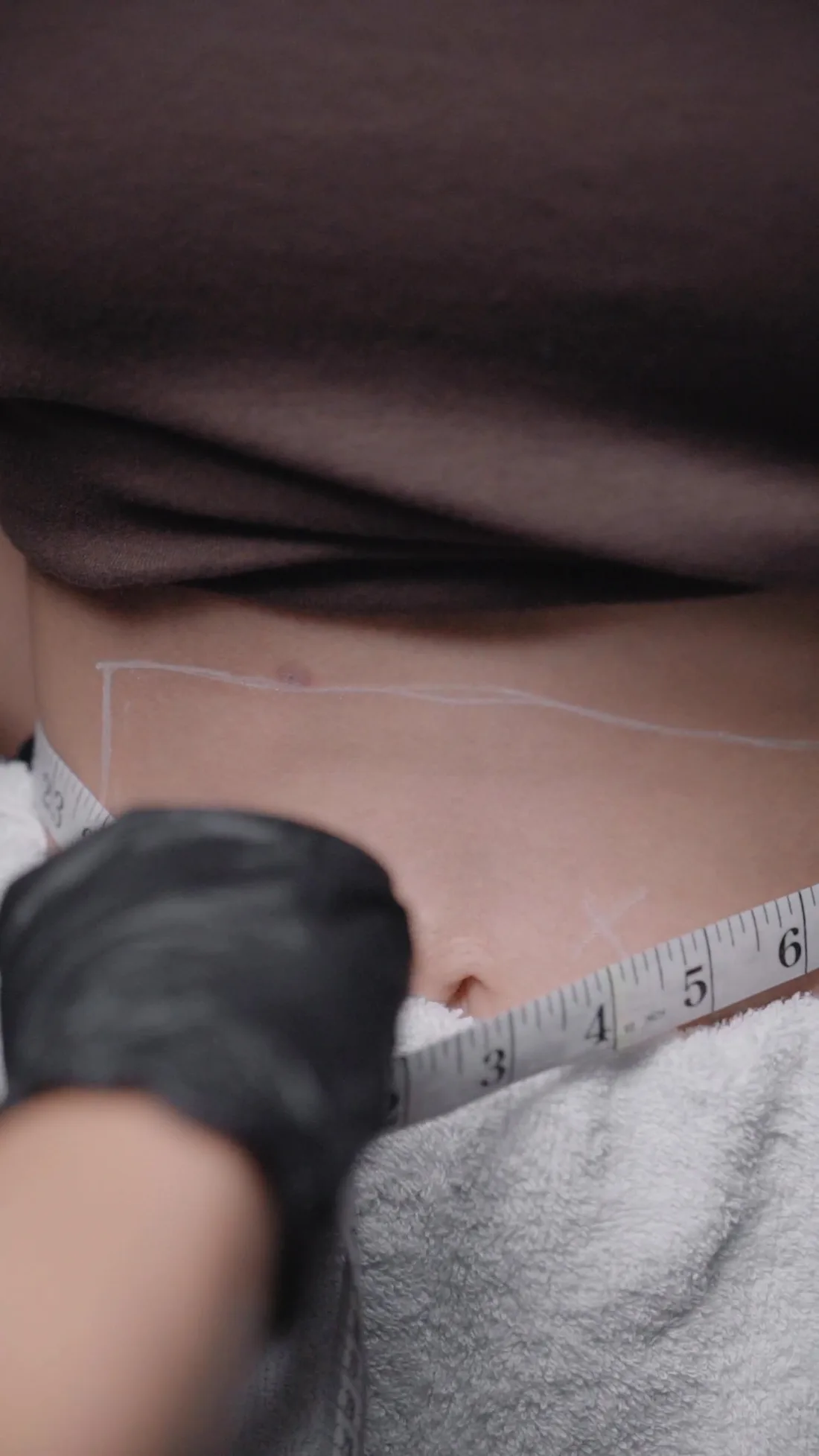 Venus SlimFit medical weight loss assessment